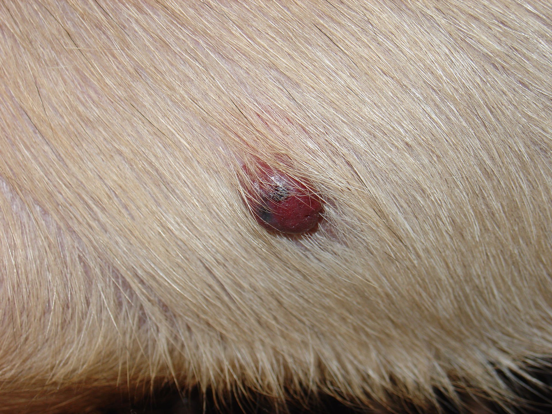 Angiosarcoma of the Breast - Hopkins Medicine