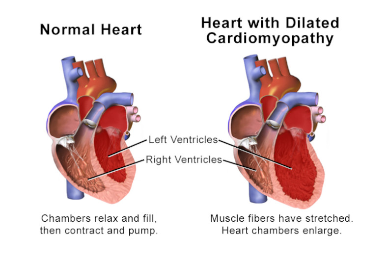 teacup dogs heart disease