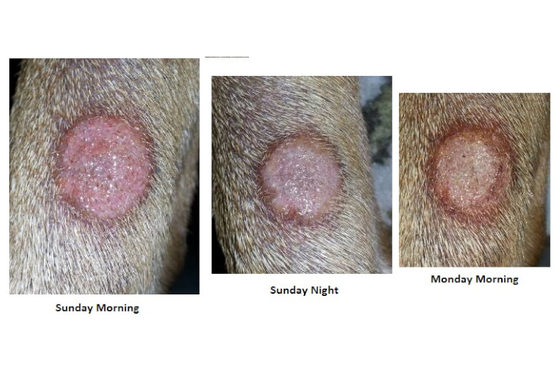 Alopecia from ringworm